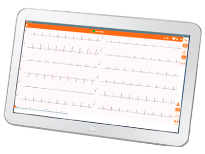 Cardioline - Eletrocardiógrafo ECG TouchECG